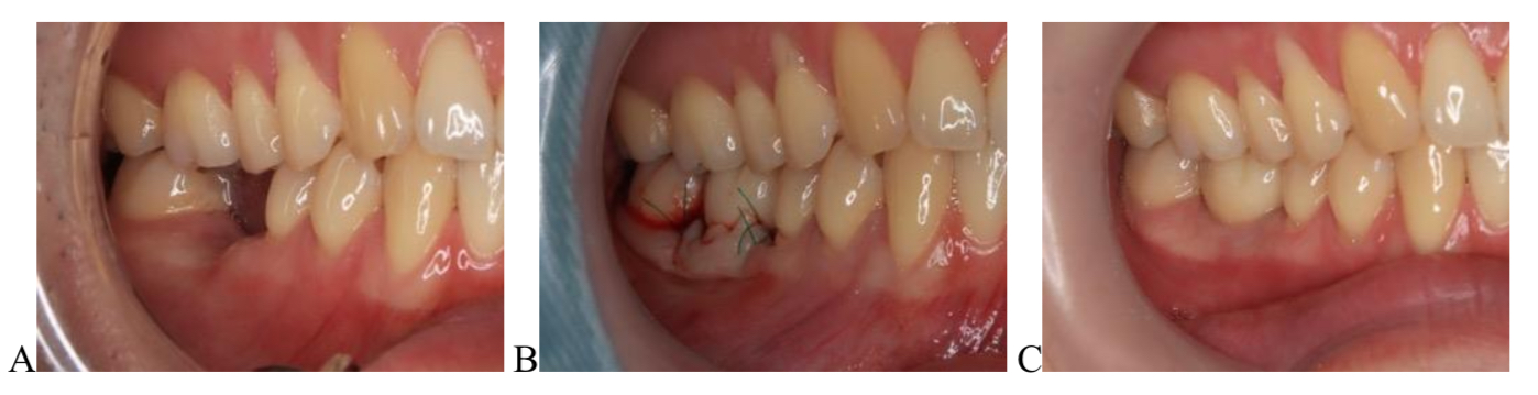 JPD掲載論文 Figure