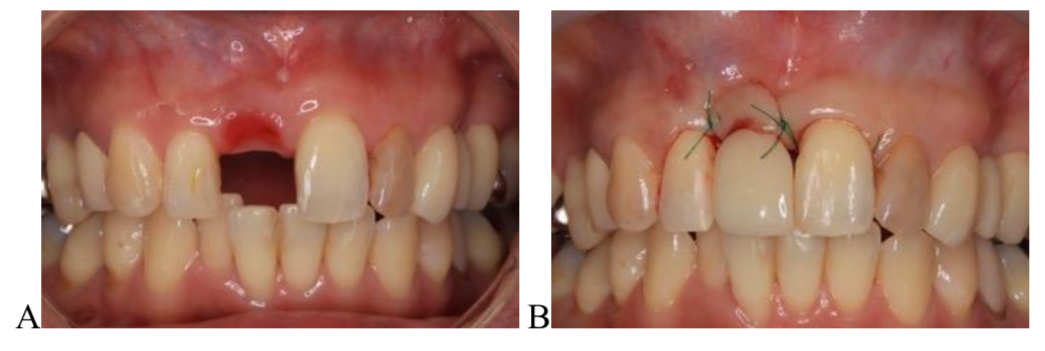JPD掲載論文 Figure