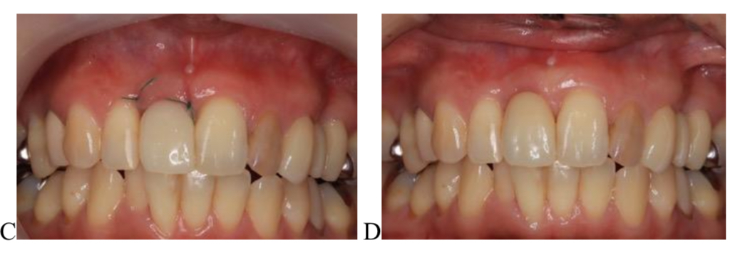 JPD掲載論文 Figure