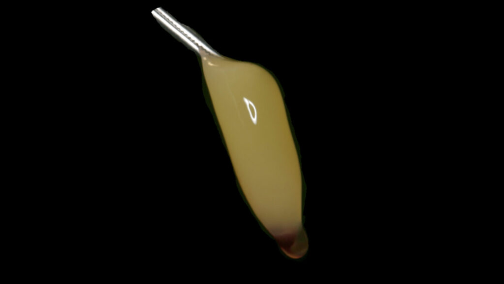患者自身の血液から作製したCGF（PRF）フィブリンゲルの実物写真